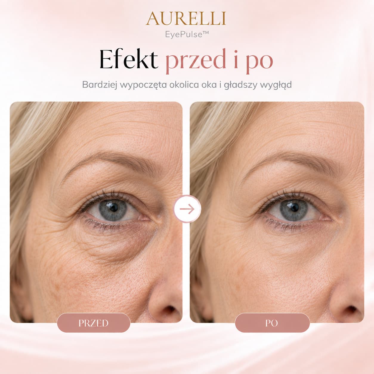 Aurelli EyePulse™